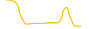 elephant-money chart