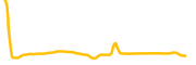 ishares-core-us-aggregate-bond-tokenized-etf-ondo chart