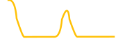 solberg chart